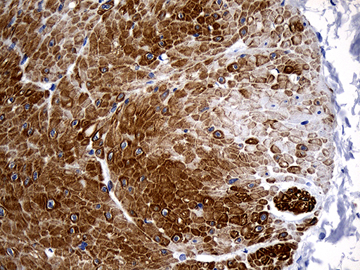 C1orf111 Antibody - Immunohistochemical staining of paraffin-embedded Human bladder tissue within the normal limits using anti-C1orf111 mouse monoclonal antibody. (Heat-induced epitope retrieval by 1mM EDTA in 10mM Tris buffer. (pH8.5) at 120°C for 3 min. (1:1000)