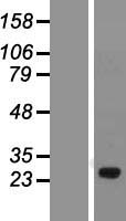 C1orf111 Protein - Western validation with an anti-DDK antibody * L: Control HEK293 lysate R: Over-expression lysate