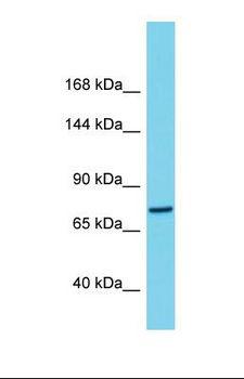 C1orf112 Antibody - Western blot of Human THP-1. C1orf112 antibody dilution 1.0 ug/ml.  This image was taken for the unconjugated form of this product. Other forms have not been tested.