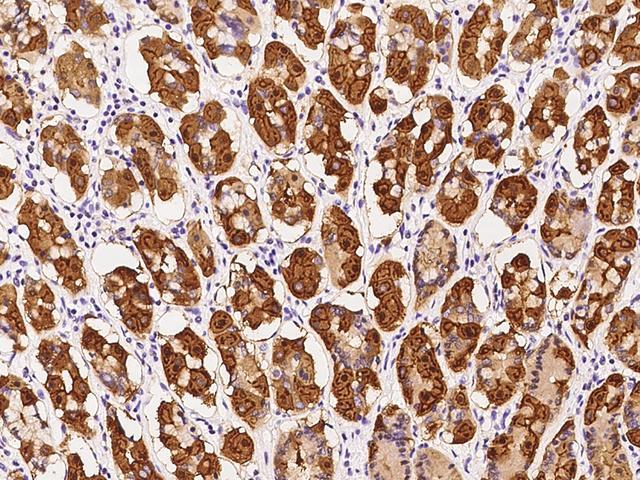 C1orf116 Antibody - Immunochemical staining of human C1orf116 in human stomach with rabbit polyclonal antibody at 1:200 dilution, formalin-fixed paraffin embedded sections.