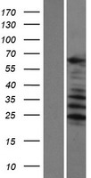 C1orf116 Protein - Western validation with an anti-DDK antibody * L: Control HEK293 lysate R: Over-expression lysate