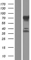 C1orf116 Protein - Western validation with an anti-DDK antibody * L: Control HEK293 lysate R: Over-expression lysate