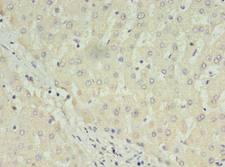 C1orf123 Antibody - Immunohistochemistry of paraffin-embedded human liver tissue using antibody at dilution of 1:100.