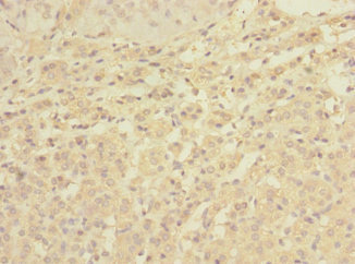 C1orf127 Antibody - Immunohistochemistry of paraffin-embedded human adrenal gland tissue using C1orf127 Antibody at dilution of 1:100