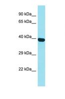 C1orf141 Antibody - Western blot of Human HepG2. C1orf141 antibody dilution 1.0 ug/ml.  This image was taken for the unconjugated form of this product. Other forms have not been tested.