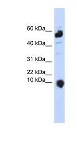 C1orf151 Antibody - C1orf151 antibody Western blot of 293T cell lysate. This image was taken for the unconjugated form of this product. Other forms have not been tested.