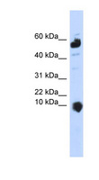 C1orf151 Antibody - C1orf151 antibody Western blot of 293T cell lysate. This image was taken for the unconjugated form of this product. Other forms have not been tested.