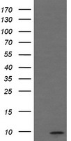 C1orf151 Antibody - HEK293T cells were transfected with the pCMV6-ENTRY control (Left lane) or pCMV6-ENTRY C1orf151 (Right lane) cDNA for 48 hrs and lysed. Equivalent amounts of cell lysates (5 ug per lane) were separated by SDS-PAGE and immunoblotted with anti-C1orf151.