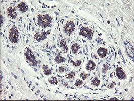 C1orf151 Antibody - IHC of paraffin-embedded Human breast tissue using anti-C1orf151 mouse monoclonal antibody.