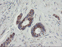 C1orf151 Antibody - IHC of paraffin-embedded Human colon tissue using anti-C1orf151 mouse monoclonal antibody.
