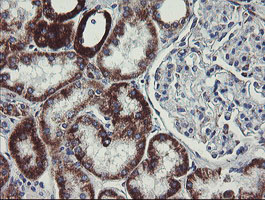 C1orf151 Antibody - IHC of paraffin-embedded Human Kidney tissue using anti-C1orf151 mouse monoclonal antibody.