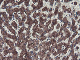 C1orf151 Antibody - IHC of paraffin-embedded Human liver tissue using anti-C1orf151 mouse monoclonal antibody.