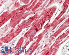 C1orf151 Antibody - Human Heart: Formalin-Fixed, Paraffin-Embedded (FFPE)