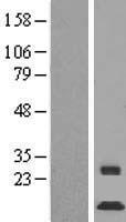 C1orf151 Protein - Western validation with an anti-DDK antibody * L: Control HEK293 lysate R: Over-expression lysate