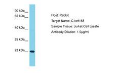 C1orf158 Antibody -  This image was taken for the unconjugated form of this product. Other forms have not been tested.