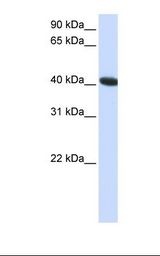 C1orf159 Antibody - HepG2 cell lysate. Antibody concentration: 1.0 ug/ml. Gel concentration: 12%.  This image was taken for the unconjugated form of this product. Other forms have not been tested.