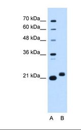 C1orf159 Antibody - Lane A: Marker. Lane B: HepG2 cell lysate. Antibody concentration: 0.25 ug/ml. Gel concentration: 12%.  This image was taken for the unconjugated form of this product. Other forms have not been tested.