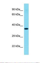 C1orf168 Antibody - Western blot of Human Hela. C1orf168 antibody dilution 1.0 ug/ml.  This image was taken for the unconjugated form of this product. Other forms have not been tested.
