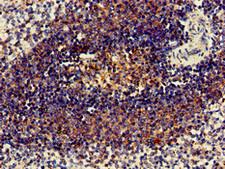C1orf177 Antibody - Immunohistochemistry of paraffin-embedded human spleen tissue using LEXM Antibody at dilution of 1:100