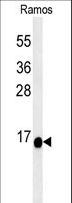 C1orf186 Antibody - C1orf186 Antibody western blot of Ramos cell line lysates (35 ug/lane). The C1orf186 antibody detected the C1orf186 protein (arrow).