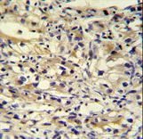 C1orf186 Antibody - C1orf186 antibody immunohistochemistry of formalin-fixed and paraffin-embedded human kidney tissue followed by peroxidase-conjugated secondary antibody and DAB staining.