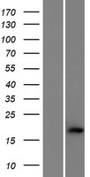 C1orf194 Protein - Western validation with an anti-DDK antibody * L: Control HEK293 lysate R: Over-expression lysate