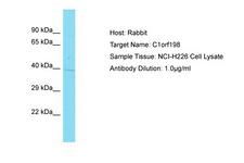 C1orf198 Antibody -  This image was taken for the unconjugated form of this product. Other forms have not been tested.