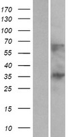 C1orf198 Protein - Western validation with an anti-DDK antibody * L: Control HEK293 lysate R: Over-expression lysate