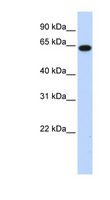 C1orf2 / FAM189B Antibody - FAM189B / C1orf2 antibody Western blot of Transfected 293T cell lysate. This image was taken for the unconjugated form of this product. Other forms have not been tested.