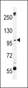 C1orf26 Antibody - CA026 Antibody western blot of MDA-MB435 cell line lysates (35 ug/lane). The CA026 antibody detected the CA026 protein (arrow).