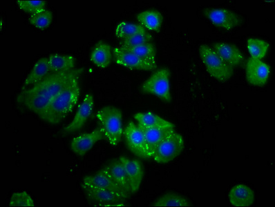 C1orf27 Antibody - Immunofluorescence staining of HepG2 cells diluted at 1:133, counter-stained with DAPI. The cells were fixed in 4% formaldehyde, permeabilized using 0.2% Triton X-100 and blocked in 10% normal Goat Serum. The cells were then incubated with the antibody overnight at 4°C.The Secondary antibody was Alexa Fluor 488-congugated AffiniPure Goat Anti-Rabbit IgG (H+L).