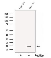 C1orf31 Antibody - Western blot analysis of extracts of HEK293 cells using C1orf31 antibody. The lane on the left was treated with blocking peptide.