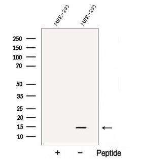 C1orf31 Antibody - Western blot analysis of extracts of HEK293 cells using C1orf31 antibody. The lane on the left was treated with blocking peptide.