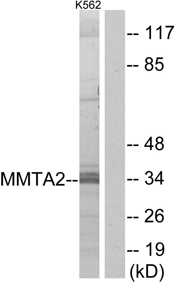 C1orf35 / MMTAG2 Antibody - Western blot analysis of lysates from K562 cells, using MMTAG2 Antibody. The lane on the right is blocked with the synthesized peptide.