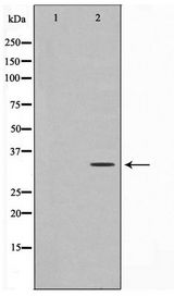 C1orf35 / MMTAG2 Antibody - Western blot of K562 cell lysate using MMTAG2 Antibody