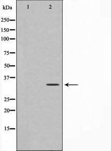 C1orf35 / MMTAG2 Antibody - Western blot analysis on K562 cell lysates using MMTAG2 antibody. The lane on the left is treated with the antigen-specific peptide.