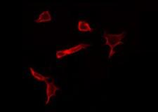 C1orf35 / MMTAG2 Antibody - Staining HeLa cells by IF/ICC. The samples were fixed with PFA and permeabilized in 0.1% Triton X-100, then blocked in 10% serum for 45 min at 25°C. The primary antibody was diluted at 1:200 and incubated with the sample for 1 hour at 37°C. An Alexa Fluor 594 conjugated goat anti-rabbit IgG (H+L) Ab, diluted at 1/600, was used as the secondary antibody.
