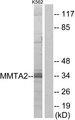 C1orf35 / MMTAG2 Antibody - Western blot analysis of extracts from K562 cells, using MMTA2 antibody.