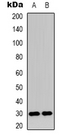 C1orf35 / MMTAG2 Antibody - Western blot analysis of MMTAG2 expression in HEK293T (A); A431 (B) whole cell lysates.