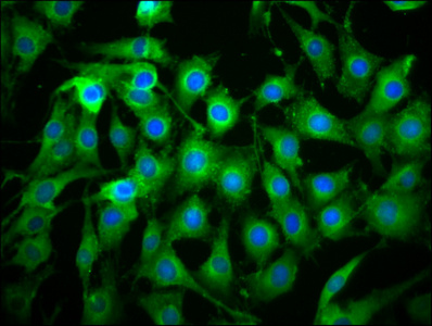 C1orf38 Antibody - Immunofluorescence staining of NIH/3T3 cells diluted at 1:133, counter-stained with DAPI. The cells were fixed in 4% formaldehyde, permeabilized using 0.2% Triton X-100 and blocked in 10% normal Goat Serum. The cells were then incubated with the antibody overnight at 4°C.The Secondary antibody was Alexa Fluor 488-congugated AffiniPure Goat Anti-Rabbit IgG (H+L).