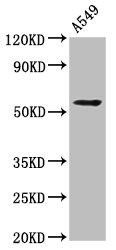 C1orf38 Antibody - Western Blot Positive WB detected in: A549 whole cell lysate All Lanes: THEMIS2 antibody at 4.2µg/ml Secondary Goat polyclonal to rabbit IgG at 1/50000 dilution Predicted band size: 73, 30, 57, 14, 58, 51 KDa Observed band size: 57 KDa