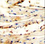 C1orf42 / NICE-1 Antibody - CRCT1 antibody immunohistochemistry of formalin-fixed and paraffin-embedded mouse heart tissue followed by peroxidase-conjugated secondary antibody and DAB staining.