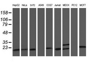 C1orf50 Antibody - Western blot of extracts (35 ug) from 9 different cell lines by using anti-C1orf50 monoclonal antibody.