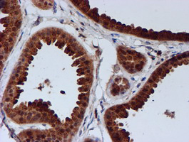 C1orf50 Antibody - IHC of paraffin-embedded Human breast tissue using anti-C1orf50 mouse monoclonal antibody.