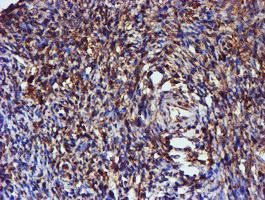 C1orf50 Antibody - IHC of paraffin-embedded Human Ovary tissue using anti-C1orf50 mouse monoclonal antibody.
