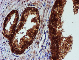 C1orf50 Antibody - IHC of paraffin-embedded Human prostate tissue using anti-C1orf50 mouse monoclonal antibody.