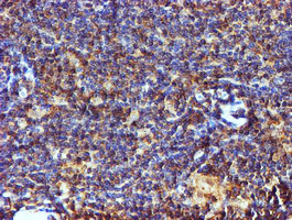 C1orf50 Antibody - IHC of paraffin-embedded Human lymphoma tissue using anti-C1orf50 mouse monoclonal antibody.