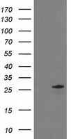 C1orf50 Antibody - HEK293T cells were transfected with the pCMV6-ENTRY control (Left lane) or pCMV6-ENTRY C1orf50 (Right lane) cDNA for 48 hrs and lysed. Equivalent amounts of cell lysates (5 ug per lane) were separated by SDS-PAGE and immunoblotted with anti-C1orf50.