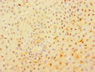 C1orf54 Antibody - Immunohistochemistry of paraffin-embedded human tonsil tissue using C1orf54 Antibody at dilution of 1:100