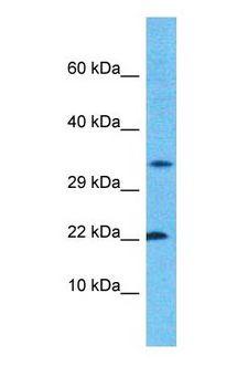 C1orf61 Antibody - Western blot of CROC4 Antibody with human ACHN Whole Cell lysate.  This image was taken for the unconjugated form of this product. Other forms have not been tested.